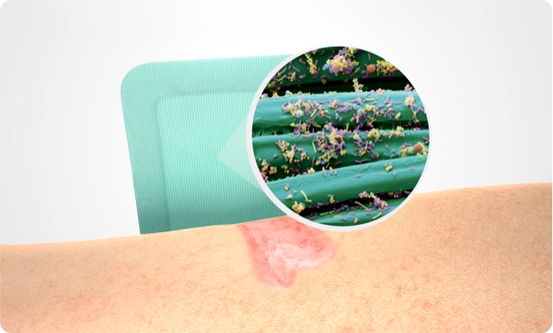 Video preview with an illustration showing a wound, Sorbact Superabsorbent and a microscopic image with microbes on a Sorbact surface